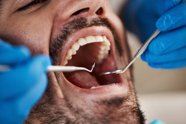Best Same-Day Emergency Dental Services in Lowell, AR