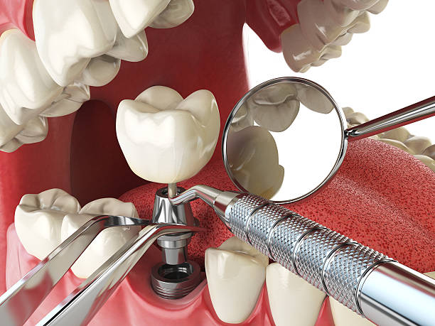 Best Same-Day Emergency Dental Services in Lowell, AR